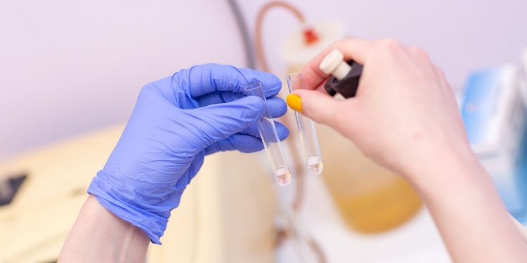 All About NAD+ IV Drip – Nicotinamide Adenine Dinucleotide IV Therapy