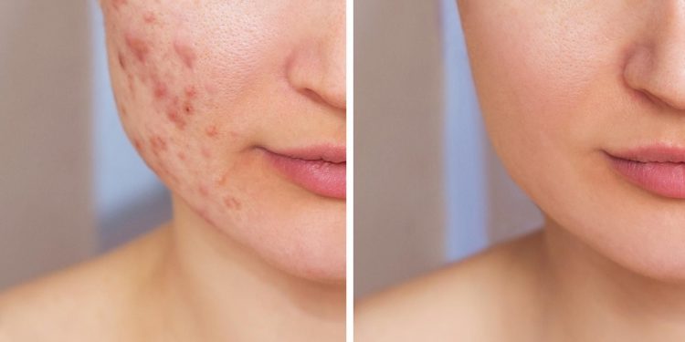 The Effect of Diet on Skin Health: A Comprehensive Guide from a Skin Doctor’s Perspective