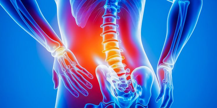 Approaches to Treating Chronic Lower Back Pain, Muscle Tears, and HIV-Related Back Pain