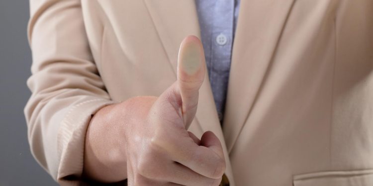 Trigger Thumb: Symptoms, Causes, and Treatment