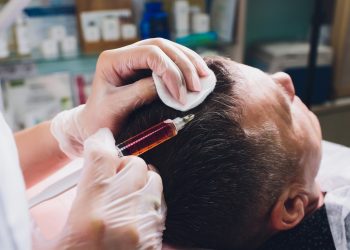Hair Transplant London: Restore Your Confidence with Capital Hair Restoration