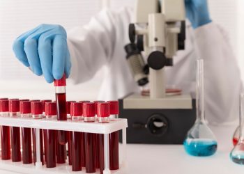 Subclinical Hypothyroidism: A Closer Look Through Blood Testing