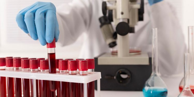 Subclinical Hypothyroidism: A Closer Look Through Blood Testing